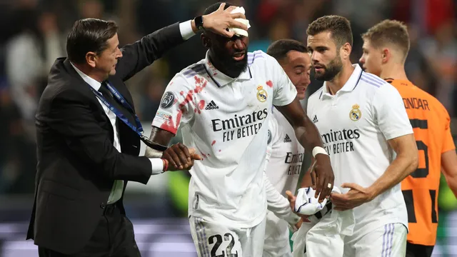 Rüdiger deixa campo com sangramento no rosto após marcar gol de empate do Real Madrid com Shakhtar